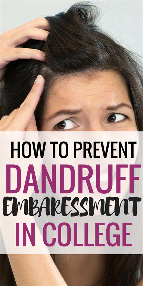 Effects and ways to prevent. With the terrible water quality at school, get dandruff is ...