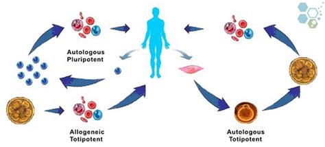 Allogeneic Stem Cells And Allogeneic Cell Transplantation