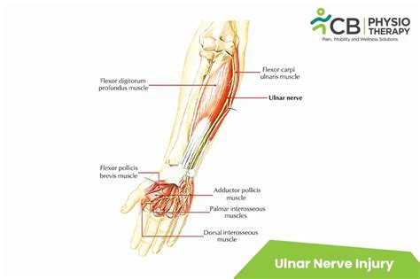 What Is Ulnar Nerve Injury Symptoms Causes Diagnosis