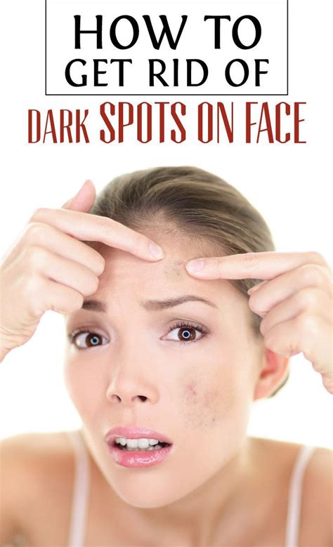 What causes dark spots on your legs? How To Get Rid Of Dark Spots On Face | Dark spots on face ...