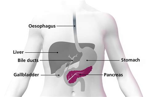 What Is Pancreatic Cancer Nhs