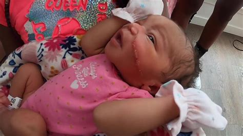 Newborn Babys Face Gets Cut During Emergency C Section