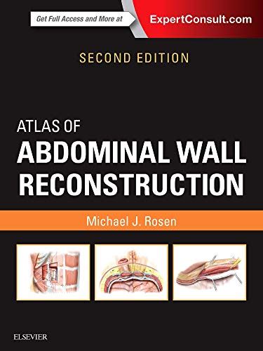 Atlas Of Abdominal Wall Reconstruction 2nd Edition Videos Organized