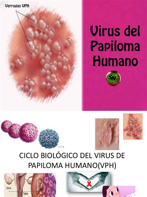 Virus Del Papiloma Humano Virus Biología Celular Free 30 Day