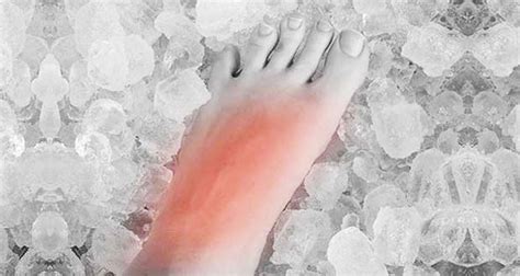 Pain On Top Of The Foot Injuries Causes Treatment And Exercises