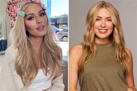 Bachelor Colton Underwood S Ex Cassie Randolph Admits She Got Cheek Filler And Botox After