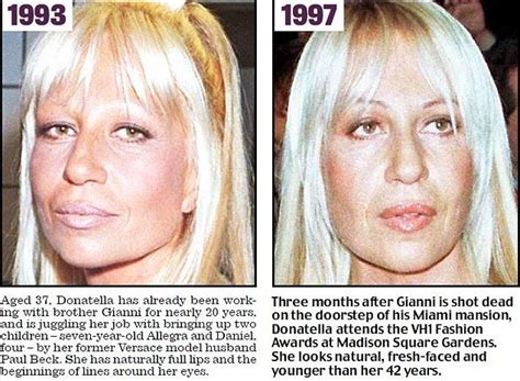 How Donatella Versace Transformed Herself Into A Human Waxwork With Botox Implants And Laser