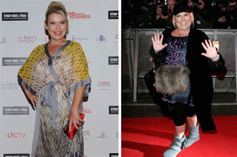 Shameless Star Tina Malone Backs Call For Obese To Get Fat Loss Surgery
