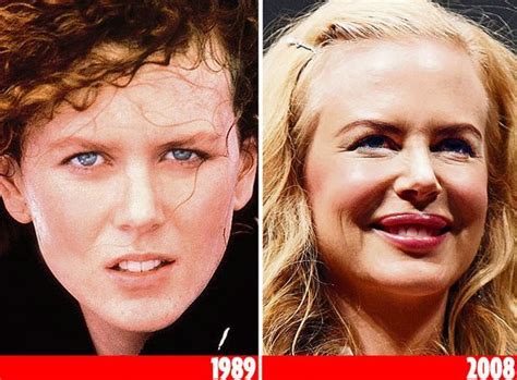 which celebrities have had cosmetic surgery celebrity plastic surgery celebrity surgery
