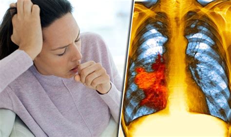 Lung Cancer Symptoms Signs Include A Cough And Feeling Tired Express