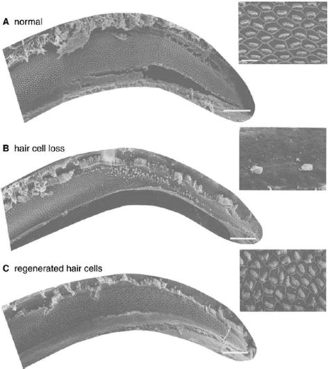 Auditory Hair Cells In The Bengalese Finch Regenerate After Original