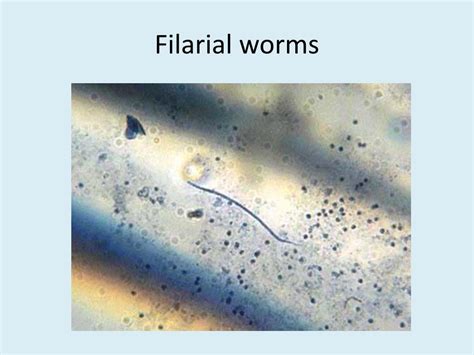 Ppt Phylum Nematoda Powerpoint Presentation Free Download Id2168158