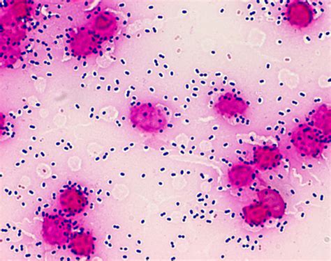 Streptococcus Pneumoniae Pleurav Gram F Grace Bio Labs