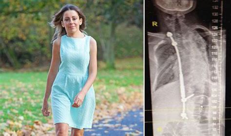 Scoliosis Sufferer Has Robotic Magnetic Spine Operation Uk