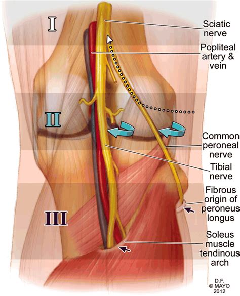 Combined Common Peroneal And Tibial Nerve Injury After Knee Dislocation One Injury Or Two An