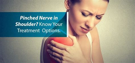 Pinched Nerve In Shoulder Know Your Treatment Options Njso