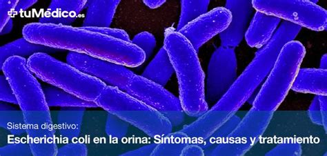 Escherichia coli en la orina Síntomas causas y tratamiento