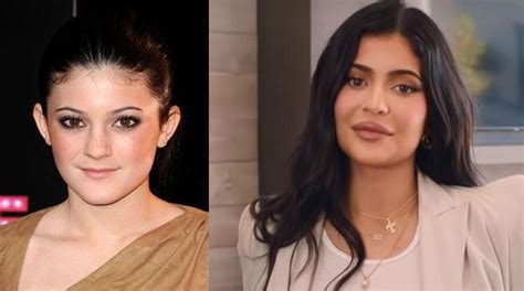 kylie jenner breaks silence on misconception about having so many face surgeries