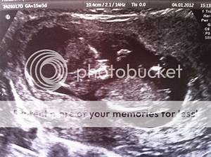 20 Week Scan Calling All Nub Experts Babycentre