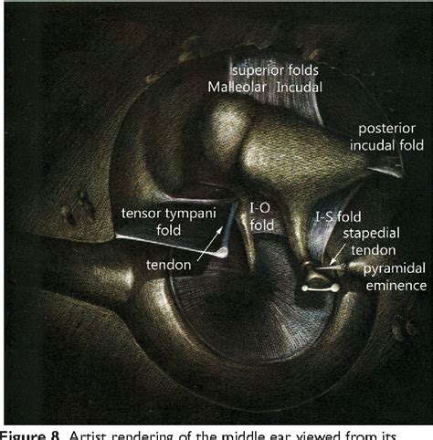 Figure 3 From Endoscopic Anatomy Of The Pediatric Middle Ear Semantic