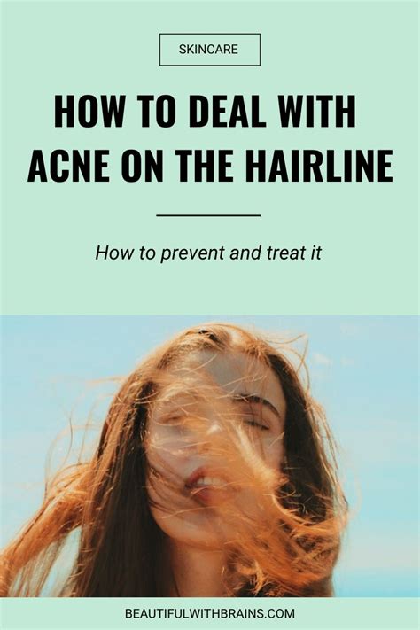 How To Deal With Acne Along The Hairline Beautiful With Brains