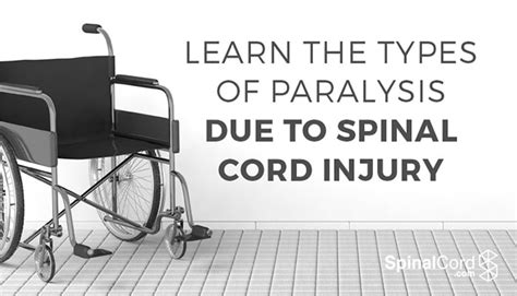 Types Of Paralysis Monoplegia Hemiplegia Paraplegia And Quadriplegia