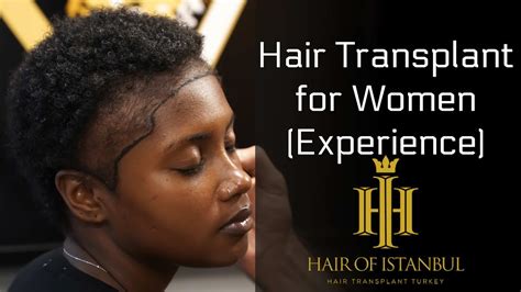 We have officially partnered with turkey's top 25 ministry of health approved & jci accredited clinics & hospitals. Hair Transplant Turkey: for Afro-American Ladies (Review ...