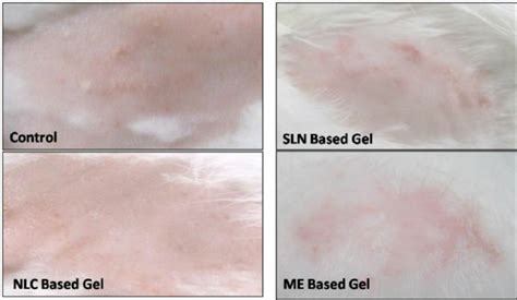Photographs Of Primary Skin Irritation Open Draize Patch Test Studies
