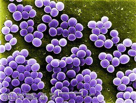 Klasifikasi Dan Morfologi Bakteri Staphylococcus Aureus Kumpulan