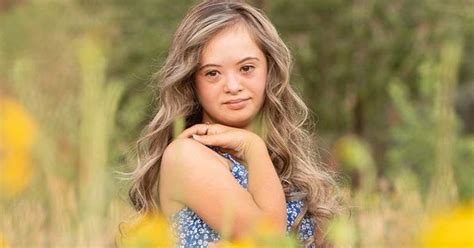 Teen Model With Down Syndrome Is Breaking Barriers With High Profile Modeling Campaigns Search