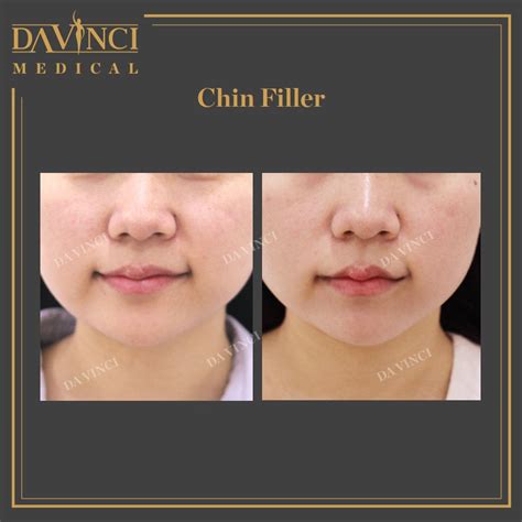 Da Vinci Clinic Chin