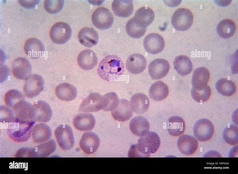 Schuffners Dots Malaria Lm Stock Photo Royalty Free Image