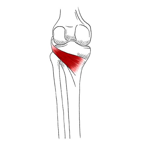 Popliteus Pain And Trigger Points