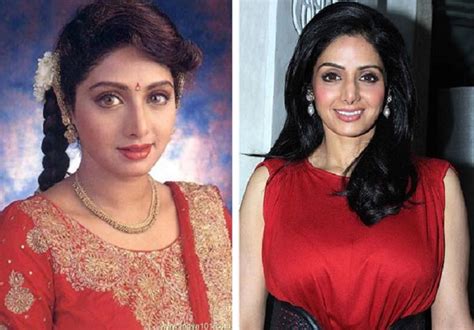List Of Bollywood Actresses Who Have Had Cosmetic Surgery Some Are Disasters Meneses Acurnhooks