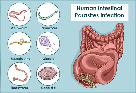 10 Signs You May Have A Parasite Manhattan Gastroenterology