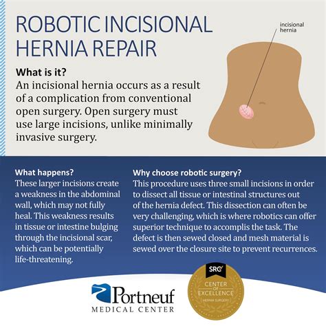 Hernia Repair Procedures Idaho Hernia Center