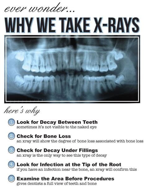 How To Read Dental X Rays