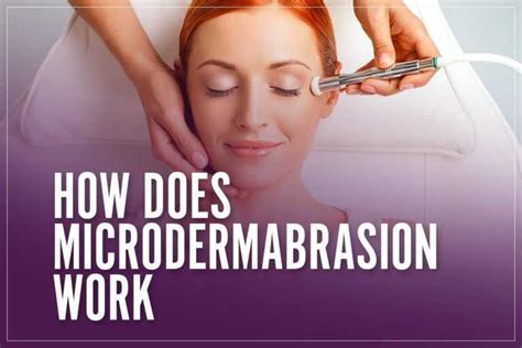 How Does Microdermabrasion Work What Does It Do For Your Skin