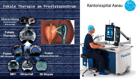 Therapie Frühstadium Prostatakrebs Prostatazentrum Kantonsspital Aarau