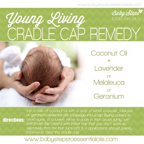 What Is The Best Treatment For Cradle Cap
