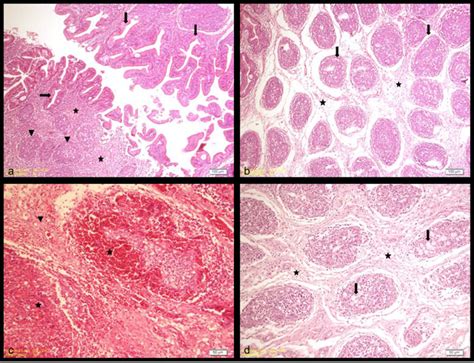 Histopathological Lesions In The Bursa Of Fabricius In Chickens