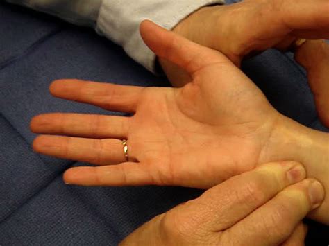 Home » apps » tools » allentest2. Allen Test | Hand Surgery Source