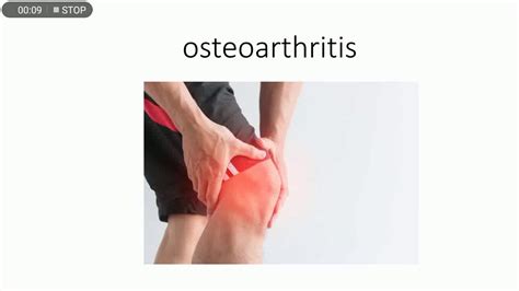 Osteoarthritis Youtube