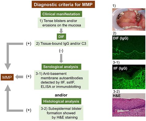Frontiers The Diagnosis And Blistering Mechanisms Of Mucous Membrane