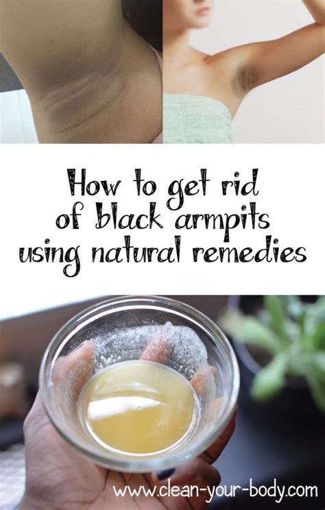 How To Get Rid Of Black Armpits Using Natural Remedies Beauty Care Black Armpits Natural