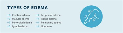 Edema Guide What Is Edema Tactile Medical 2023