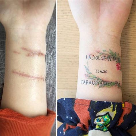 10 Amazing Tattoos That Turn Scars Into Works Of Art Bored Panda