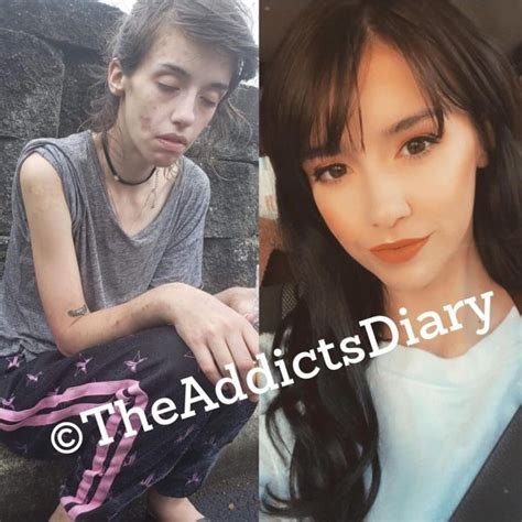 22 Before And After Pics Of People Who Quit Drugs Ftw