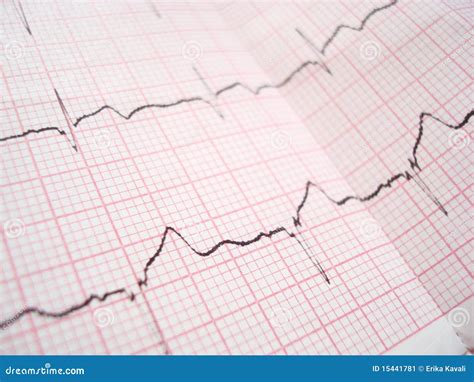 Ecg Electrocardiography Diagram Stock Image Image 15441781