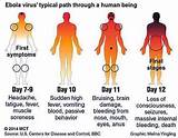 Control Of Ebola Virus Pictures